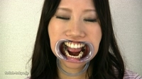 ナオちゃんの「歯」観察　画像データ写真23枚付！