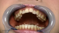 口内「歯」観察みなみチャンの巻画像データ写真付