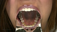 フェチ：熟女の口内「歯」観察　データ写真付