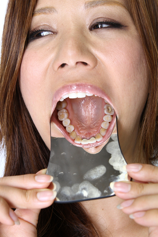 熟女の口内「歯」観察　データ写真付