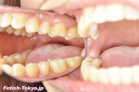 フェチ：歯の写真集【画像データ2名分54枚】