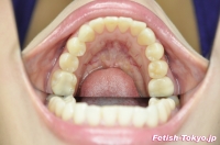 フェチ：歯の写真集【画像データ2名分54枚】