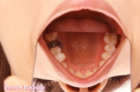 フェチ：口内「歯」写真集２名分