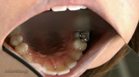 口内「歯」観察あみチャン　データ写真１９枚収録