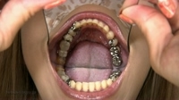 黒ギャルの「歯」観察動画