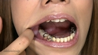 フェチ：黒ギャルの「歯」観察動画