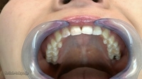 フェチ：歯観察・神谷ゆきの口内事情
