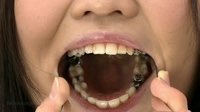 フェチ：千沙さんの歯カンサツ