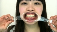 フェチ：今井花菜チャンの可憐なワンポイント銀歯