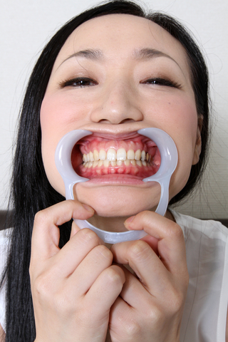 綾さんの歯