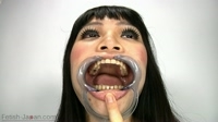 田中由美さんの歯観察。
